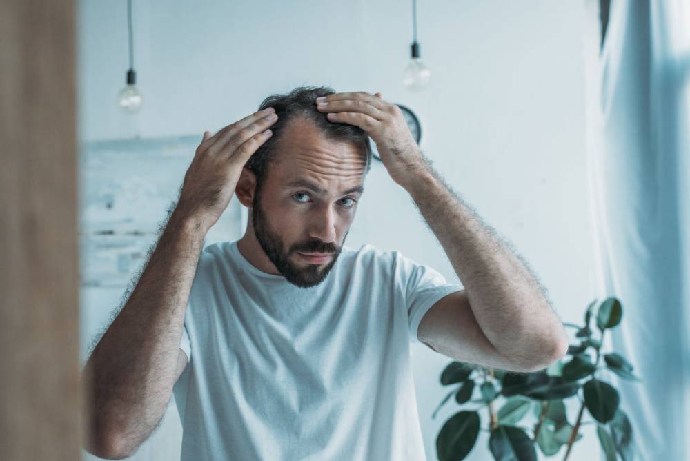 perte de cheveux à Le Mans